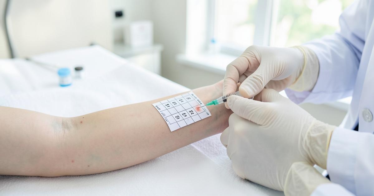 What Are the Different Types of Allergy Tests